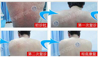 ¹ãÖÝ·ô¿µÆ¤·ô²¡Ò½Ôº