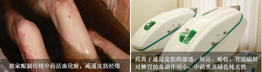 广州肤康皮肤病医院