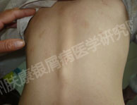 广州肤康皮肤病医院