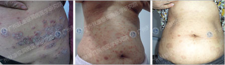 ���ݷ���Ƥ����ҽԺ