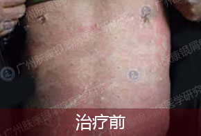 ���ݷ���Ƥ����ҽԺ