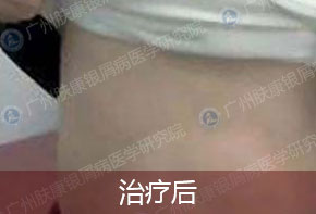 ���ݷ���Ƥ����ҽԺ